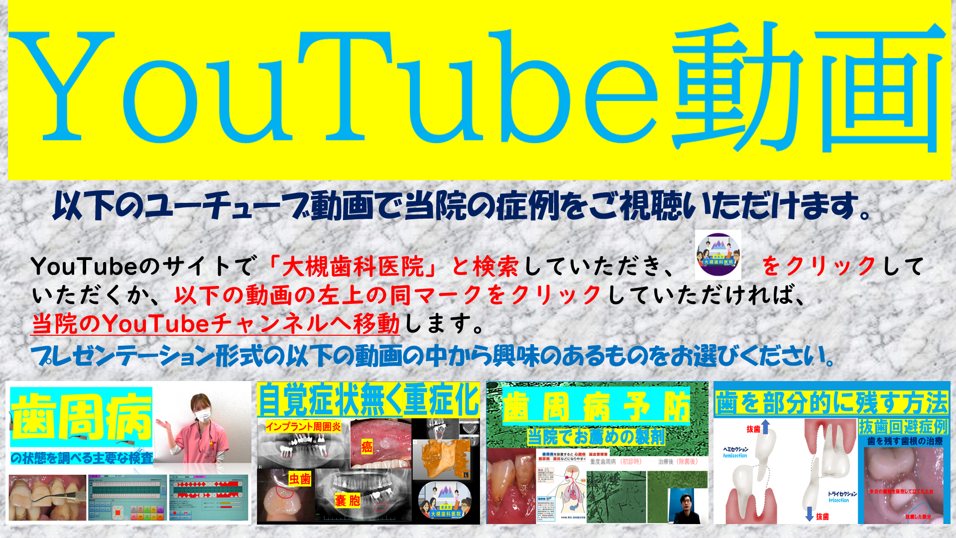 大槻歯科医院の症例をYouTube動画で見ることができます